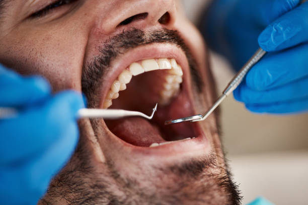 Best Emergency Dentist for Knocked-Out Tooth in Shrewsbury, NJ
